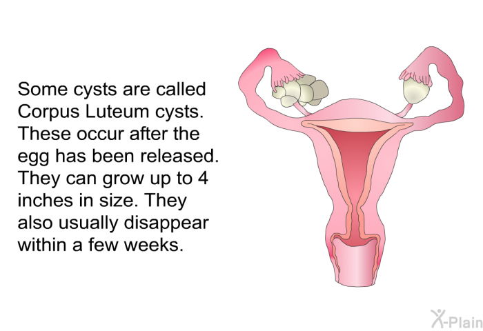 Some cysts are called Corpus Luteum cysts. These occur after the egg has been released. They can grow up to 4 inches in size. They usually also disappear within a few weeks.
