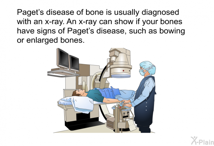 Paget's disease of bone is usually diagnosed with an x-ray. An x-ray can show if your bones have signs of Paget's disease, such as bowing or enlarged bones.