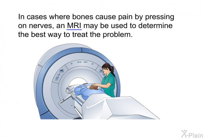 In cases where bones cause pain by pressing on nerves, an MRI may be used to determine the best way to treat the problem.
