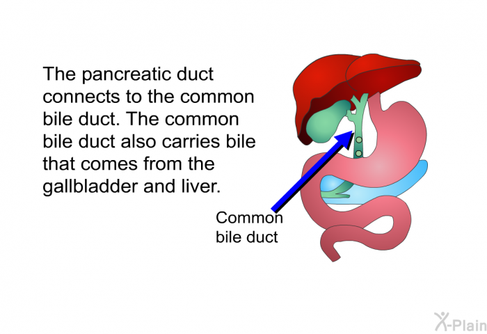 The pancreatic duct connects to the common bile duct. The common bile duct also carries bile that comes from the gall bladder and liver.