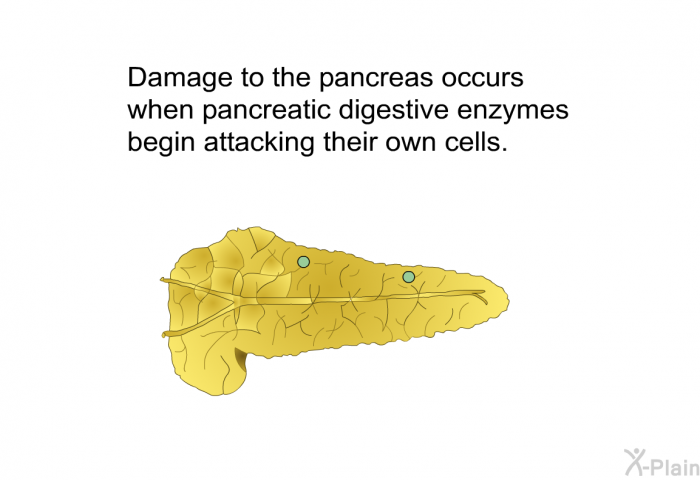 Damage to the pancreas occurs when pancreatic digestive enzymes begin attacking their own cells.