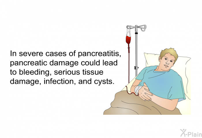 In severe cases of pancreatitis, pancreatic damage could lead to bleeding, serious tissue damage, infection, and cysts.