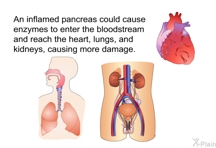 An inflamed pancreas could cause enzymes to enter the bloodstream and reach the heart, lungs, and kidneys, causing more damage.