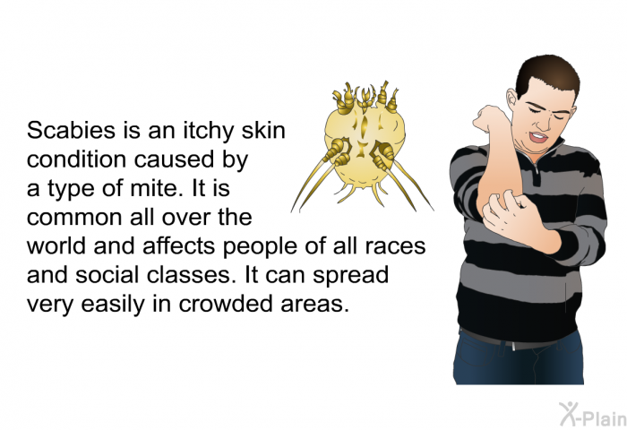 Scabies is an itchy skin condition caused by a type of mite. It is common all over the world and affects people of all races and social classes. It can spread very easily in crowded areas.