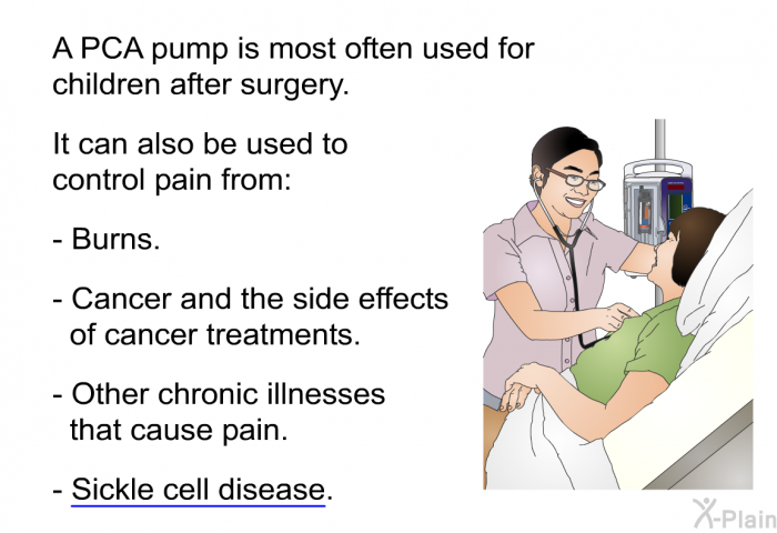 A PCA pump is most often used for children after surgery. It can also be used to control pain from:  Burns. Cancer and the side effects of cancer treatments. Other chronic illnesses that cause pain. Sickle cell disease.