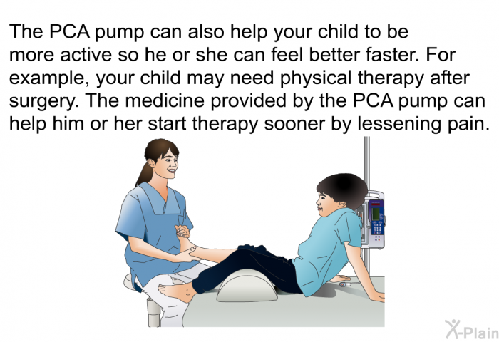 The PCA pump can also help your child to be more active so he or she can feel better faster. For example, your child may need physical therapy after surgery. The medicine provided by the PCA pump can help him or her start therapy sooner by lessening pain.