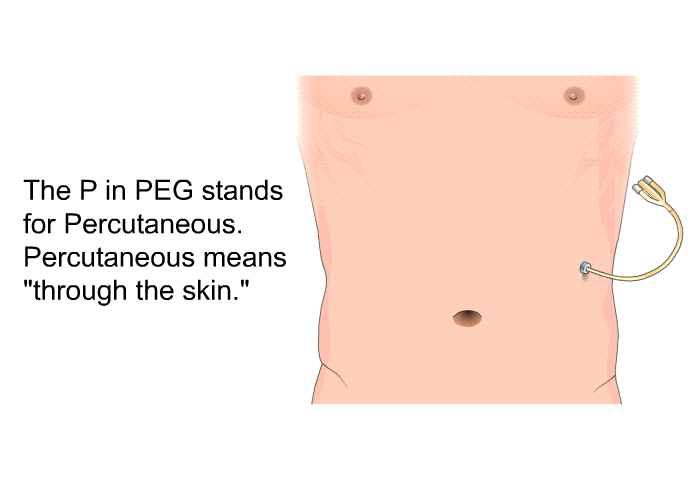 The P in PEG stands for Percutaneous. Percutaneous means “through the skin.”