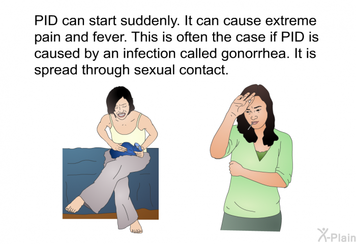 PID can start suddenly. It can cause extreme pain and fever. This is often the case if PID is caused by an infection called gonorrhea. It is spread through sexual contact.