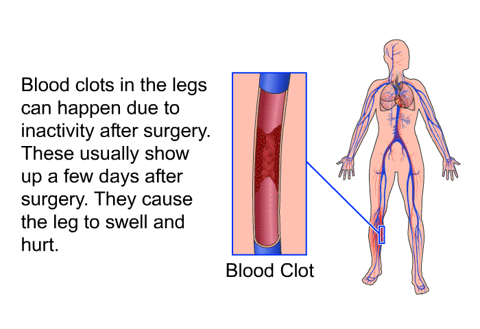 Blood clots in the legs can happen due to inactivity after surgery. These usually show up a few days after surgery. They cause the leg to swell and hurt.