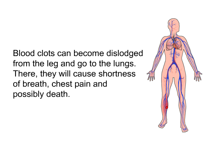 Blood clots can become dislodged from the leg and go to the lungs. There, they will cause shortness of breath, chest pain and possibly death.
