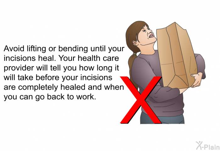 Avoid lifting or bending until your incisions heal. Your health care provider will tell you how long it will take before your incisions are completely healed and when you can go back to work.