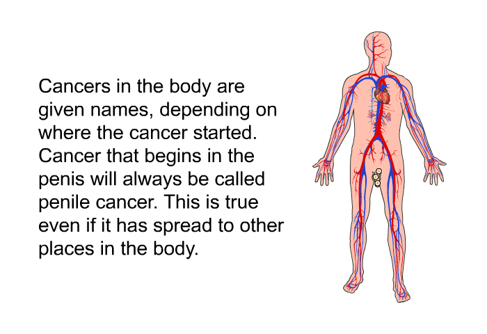 Cancers in the body are given names, depending on where the cancer started. Cancer that begins in the penis will always be called penile cancer. This is true even if it has spread to other places in the body.