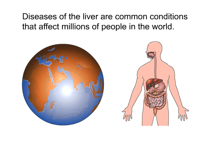 Diseases of the liver are common conditions that affect millions of people in the world.