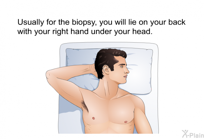 Usually for the biopsy, you will lie on your back with your right hand under your head.