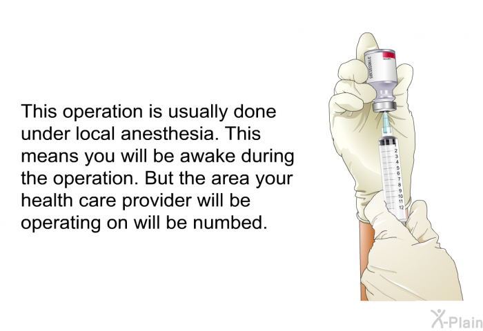 This operation is usually done under local anesthesia. This means you will be awake during the operation. But the area your health care provider will be operating on will be numbed.