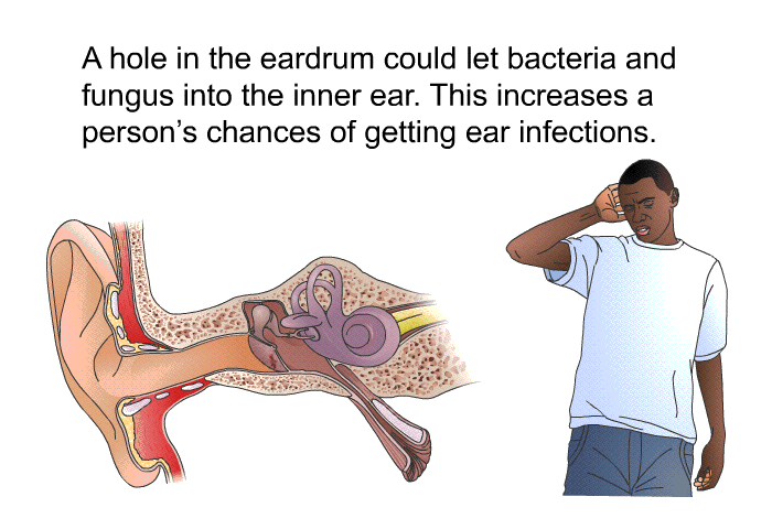 A hole in the eardrum could let bacteria and fungus into the inner ear. This increases a person's chances of getting ear infections.