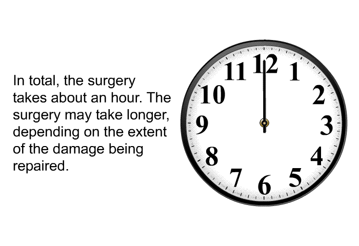 In total, the surgery takes about an hour. The surgery may take longer, depending on the extent of the damage being repaired.
