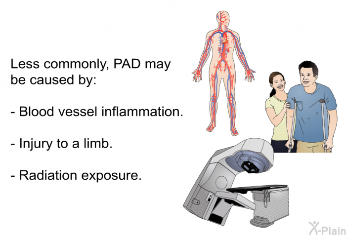 Less commonly, PAD may be caused by:  Blood vessel inflammation. Injury to a limb. Radiation exposure.