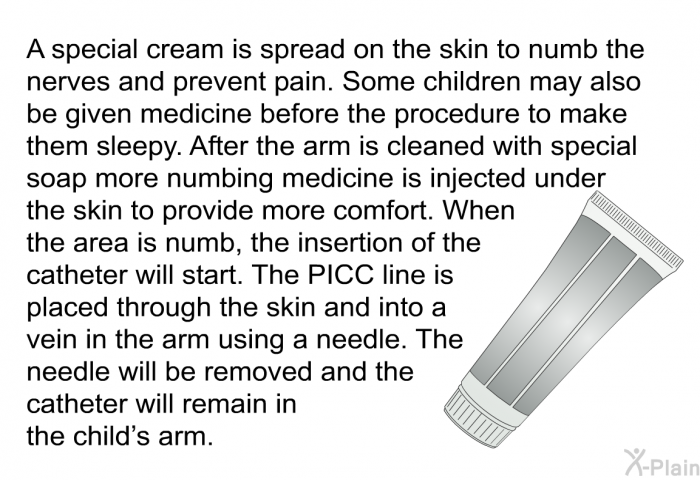 A special cream is spread on the skin to numb the nerves and prevent pain. Some children may also be given medicine before the procedure to make them sleepy. After the arm is cleaned with special soap more numbing medicine is injected under the skin to provide more comfort. When the area is numb, the insertion of the catheter will start. The PICC line is placed through the skin and into a vein in the arm using a needle. The needle will be removed and the catheter will remain in the child's arm.