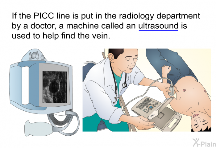 If the PICC line is put in the radiology department by a doctor, a machine called an ultrasound is used to help find the vein.