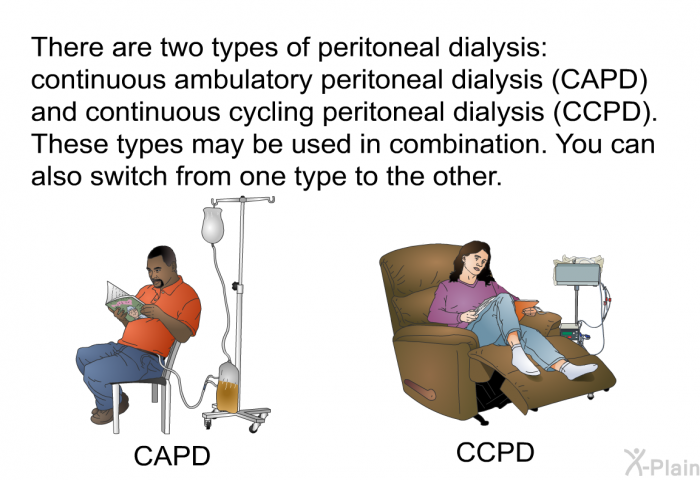 There are two types of peritoneal dialysis: continuous ambulatory peritoneal dialysis (CAPD) and continuous cycling peritoneal dialysis (CCPD). These types may be used in combination. You can also switch from one type to the other.
