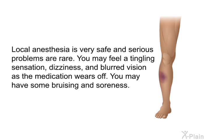 Local anesthesia is very safe and serious problems are rare. You may feel a tingling sensation, dizziness, and blurred vision as the medication wears off. You may have some bruising and soreness.