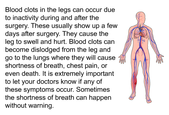 Blood clots in the legs can occur due to inactivity during and after the surgery. These usually show up a few days after surgery. They cause the leg to swell and hurt. Blood clots can become dislodged from the leg and go to the lungs where they will cause shortness of breath, chest pain, or even death. It is extremely important to let your doctors know if any of these symptoms occur. Sometimes the shortness of breath can happen without warning.