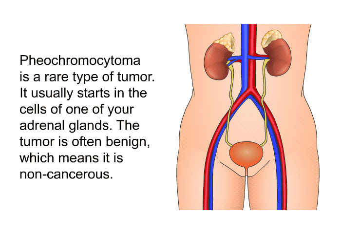 Pheochromocytoma is a rare type of tumor. It usually starts in the cells of one of your adrenal glands. The tumor is often benign, which means it is non-cancerous.
