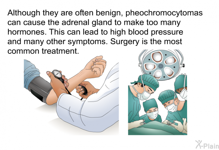 Although they are often benign, pheochromocytomas can cause the adrenal gland to make too many hormones. This can lead to high blood pressure and many other symptoms. Surgery is the most common treatment.