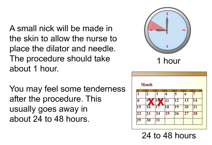 A small nick will be made in the skin to allow the nurse to place the dilator and needle. The procedure should take about 1 hour. You may feel some tenderness after the procedure. This usually goes away in about 24 to 48 hours.