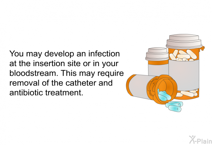 You may develop an infection at the insertion site or in your bloodstream. This may require removal of the catheter and antibiotic treatment.