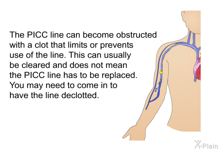 The PICC line can become obstructed with a clot that limits or prevents use of the line. This can usually be cleared and does not mean that the PICC line has to be replaced. You may need to come in to have the line declotted.