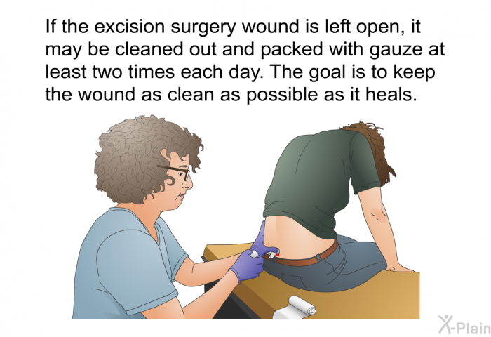 If the excision surgery wound is left open, it may be cleaned out and packed with gauze at least two times each day. The goal is to keep the wound as clean as possible as it heals.