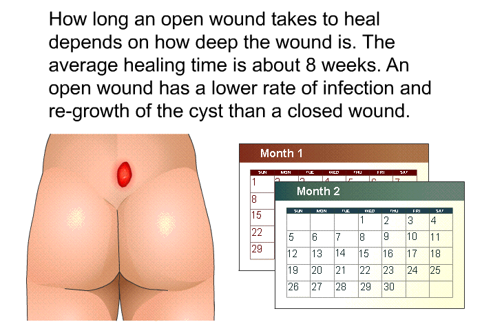 How long an open wound takes to heal depends on how deep the wound is. The average healing time is about 8 weeks. An open wound has a lower rate of infection and re-growth of the cyst than a closed wound.