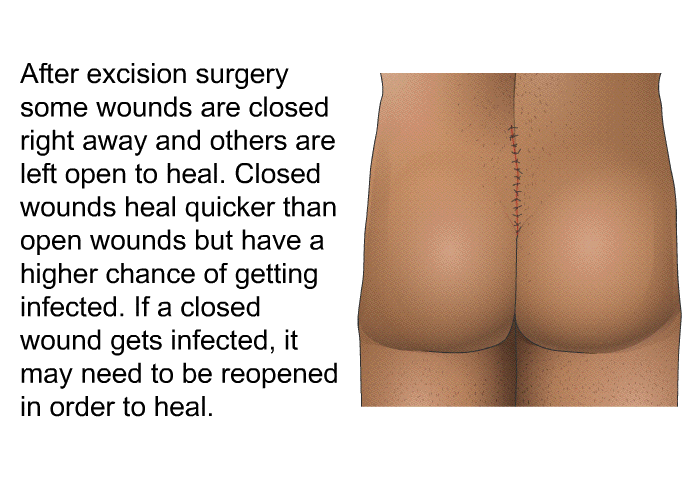 After excision surgery some wounds are closed right away and others are left open to heal. Closed wounds heal quicker than open wounds but have a higher chance of getting infected. If a closed wound gets infected, it may need to be reopened in order to heal.