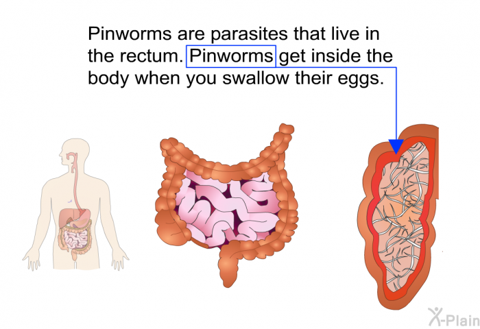 Pinworms are parasites that live in the rectum. Pinworms get inside the body when you swallow their eggs.
