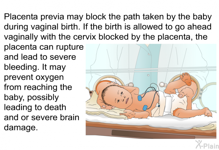 Placenta previa may block the path taken by the baby during vaginal birth. If the birth is allowed to go ahead vaginally with the cervix blocked by the placenta, the placenta can rupture and lead to severe bleeding. It may prevent oxygen from reaching the baby, possibly leading to death and or severe brain damage.