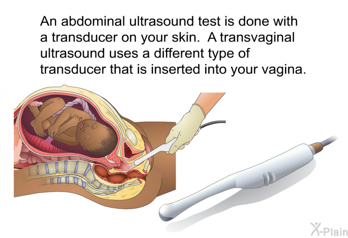 An abdominal ultrasound test is done with a transducer on your skin. A transvaginal ultrasound uses a different type of transducer that is inserted into your vagina.