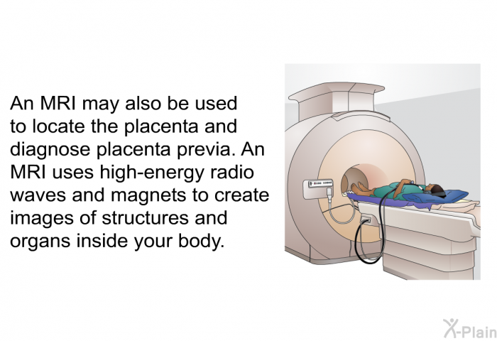An MRI may also be used to locate the placenta and diagnose placenta previa. An MRI uses high-energy radio waves and magnets to create images of structures and organs inside your body.