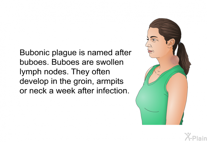Bubonic plague is named after buboes. Buboes are swollen lymph nodes. They often develop in the groin, armpits or neck a week after infection.