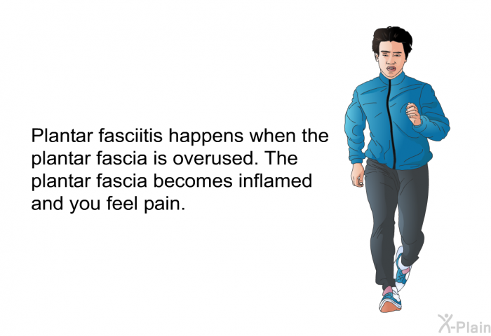 Plantar fasciitis happens when the plantar fascia is overused. The plantar fascia becomes inflamed and you feel pain.