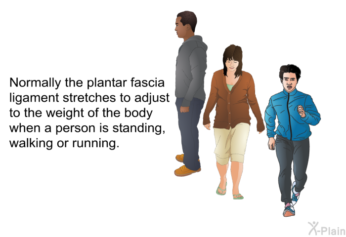 Normally the plantar fascia ligament stretches to adjust to the weight of the body when a person is standing, walking or running.