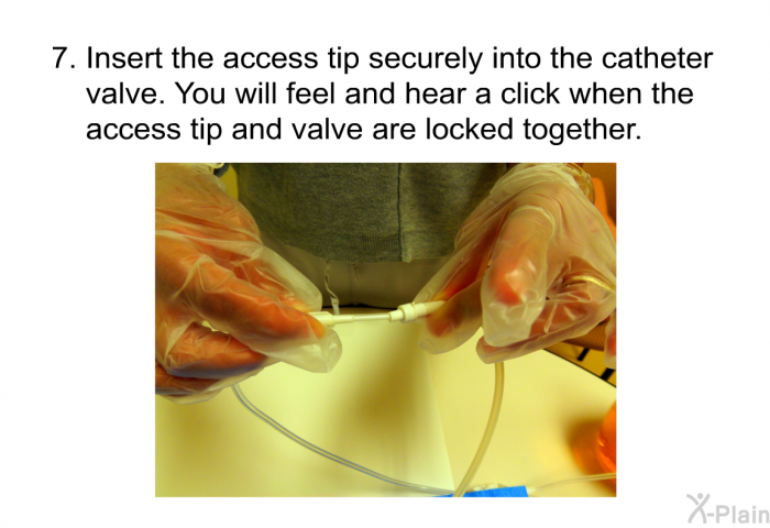 Insert the access tip securely into the catheter valve. You will feel and hear a click when the access tip and valve are locked together.