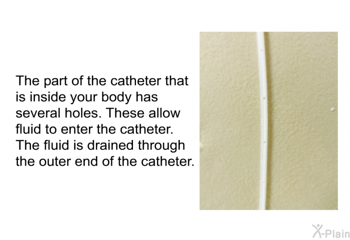 The part of the catheter that is inside your body has several holes. These allow fluid to enter the catheter. The fluid is drained through the outer end of the catheter.