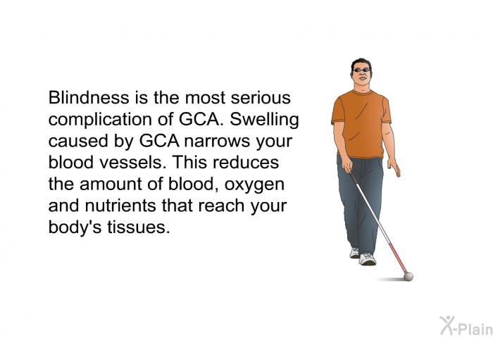 Blindness is the most serious complication of GCA. Swelling caused by GCA narrows your blood vessels. This reduces the amount of blood, oxygen and nutrients that reach your body's tissues.