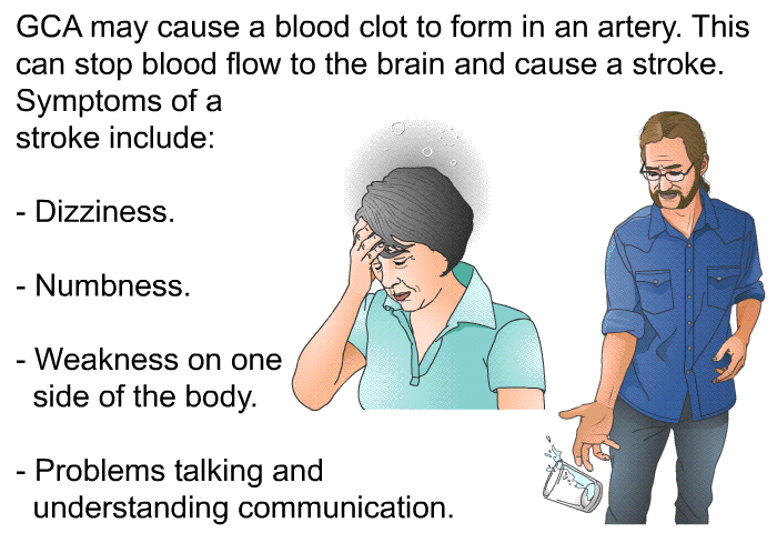 GCA may cause a blood clot to form in an artery. This can stop blood flow to the brain and cause a stroke. Symptoms of a stroke include:  Dizziness. Numbness. Weakness on one side of the body. Problems talking and understanding communication.