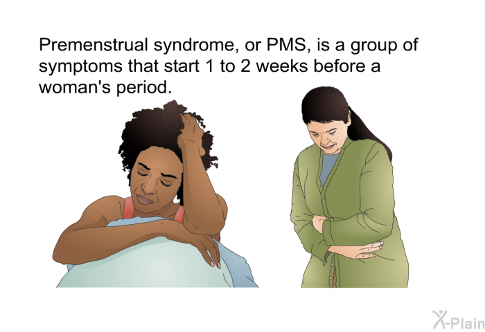 Premenstrual syndrome, or PMS, is a group of symptoms that start 1 to 2 weeks before a woman's period.