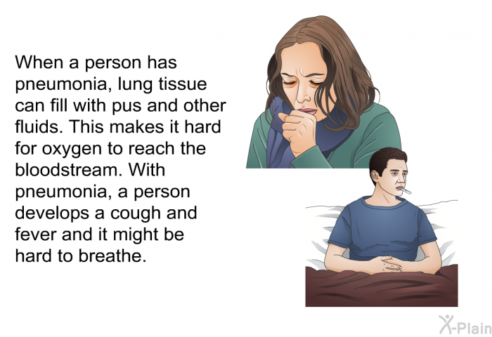 When a person has pneumonia, lung tissue can fill with pus and other fluids. This makes it hard for oxygen to reach the bloodstream. With pneumonia, a person develops a cough and fever and it might be hard to breathe.