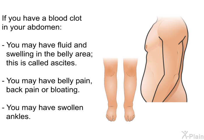 If you have a blood clot in your abdomen:  You may have fluid and swelling in the belly area; this is called ascites. You may have belly pain, back pain or bloating. You may have swollen ankles.