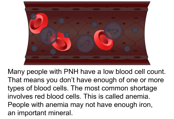 Many people with PNH have a low blood cell count. That means you don't have enough of one or more types of blood cells. The most common shortage involves red blood cells. This is called anemia. People with anemia may not have enough iron, an important mineral.